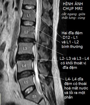 Description: Chụp MRI cho kết quả rõ nét, chuẩn xác