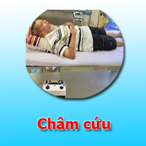 Châm cứu