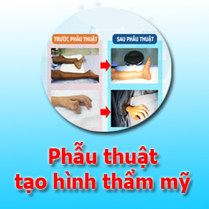 Phẫu thuật tạo hình thẩm mỹ